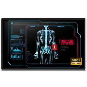 Onyx MEDDP-632F-P1 32" FHD Medical Touch Display